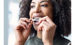 Aligners
